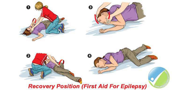 First Aid for epilepsy